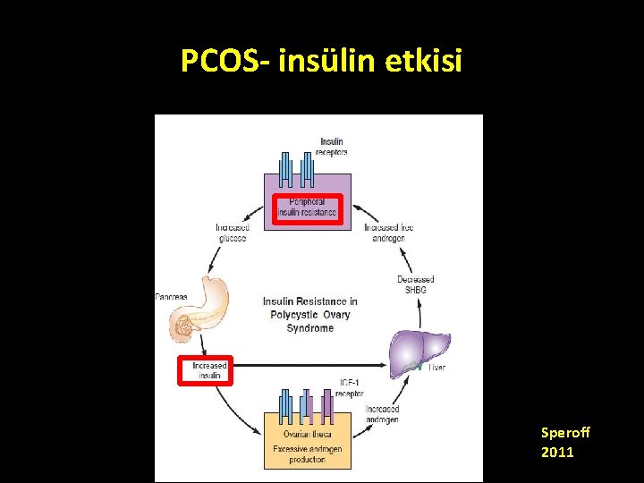 PCOS- insülin etkisi Speroff 2011 PCOS- insülin etkisi Speroff 2011
