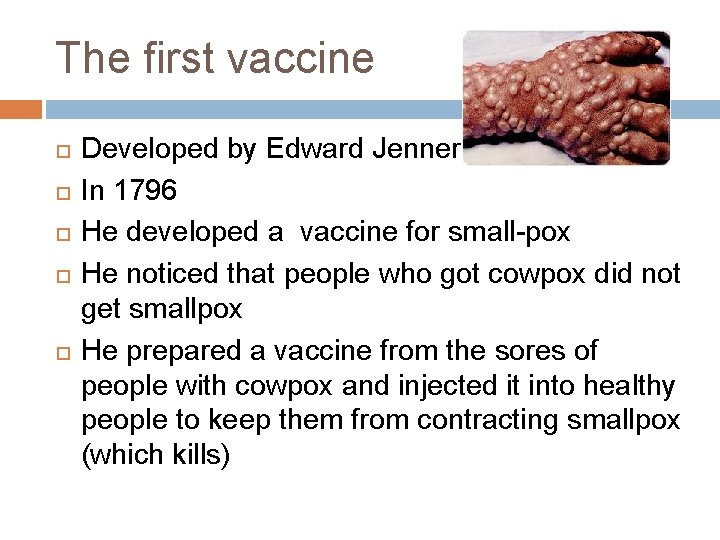 The first vaccine Developed by Edward Jenner In 1796 He developed a vaccine for The first vaccine Developed by Edward Jenner In 1796 He developed a vaccine for