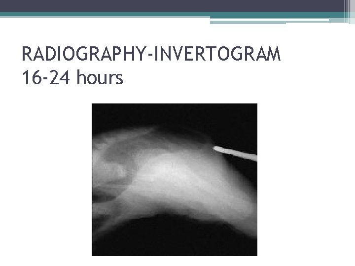 RADIOGRAPHY-INVERTOGRAM 16 -24 hours RADIOGRAPHY-INVERTOGRAM 16 -24 hours