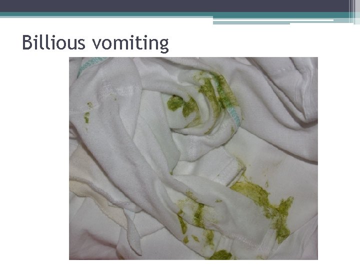 Billious vomiting Billious vomiting