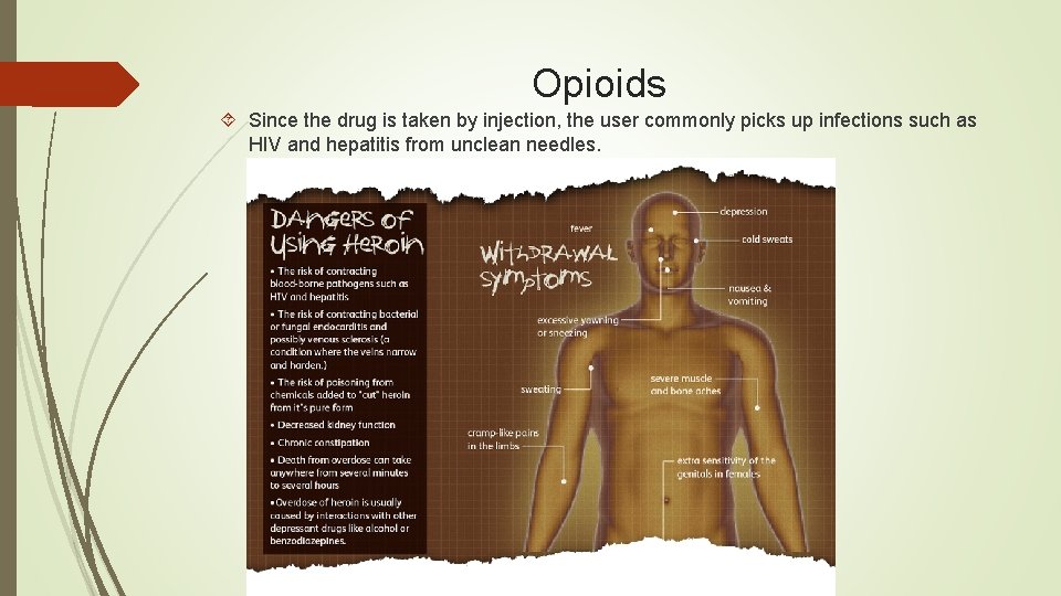 Opioids Since the drug is taken by injection, the user commonly picks up infections