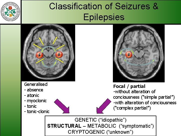 Classification of Seizures & Epilepsies Generalised - absence - atonic - myoclonic - tonic-clonic