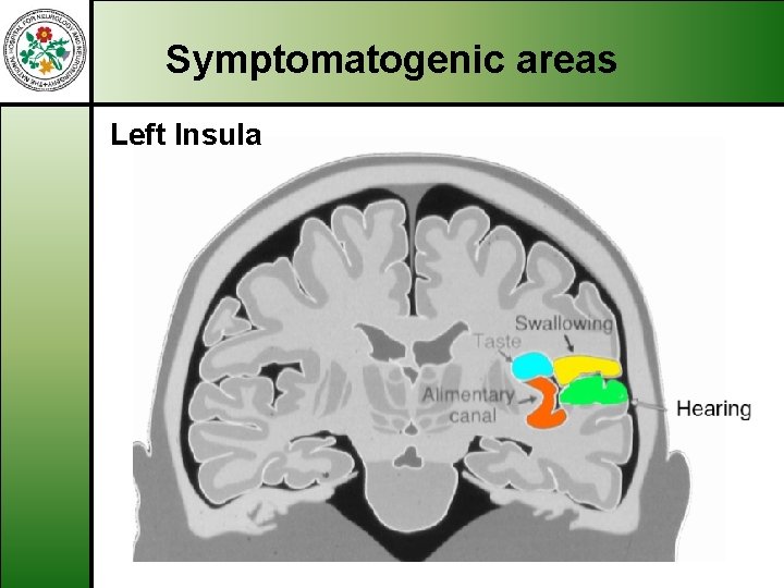 Symptomatogenic areas Left Insula 