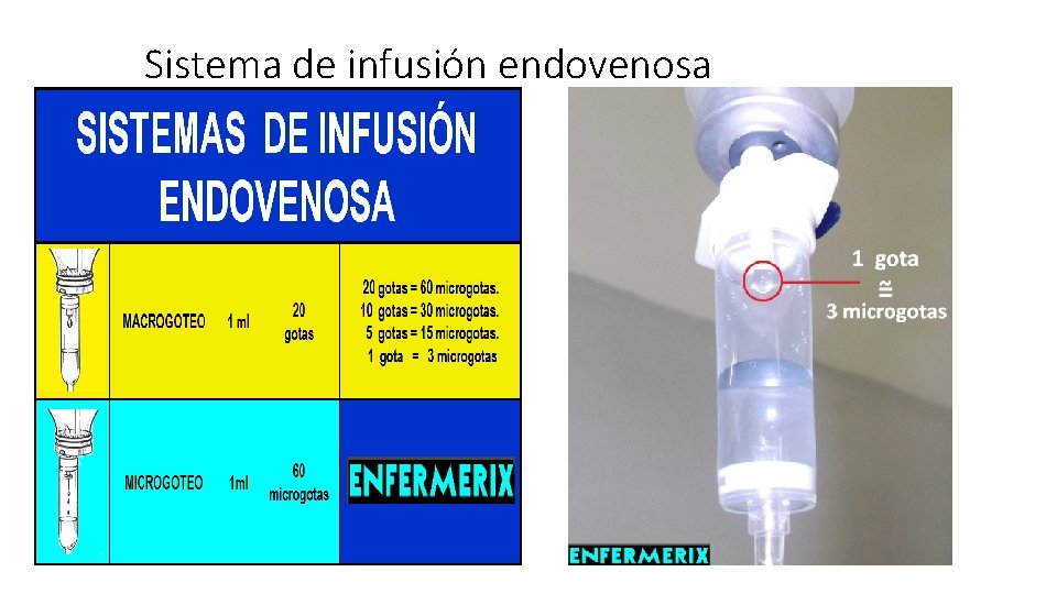 Sistema de infusión endovenosa 