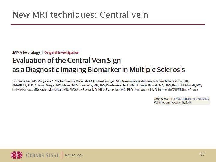 New MRI techniques: Central vein 27 New MRI techniques: Central vein 27
