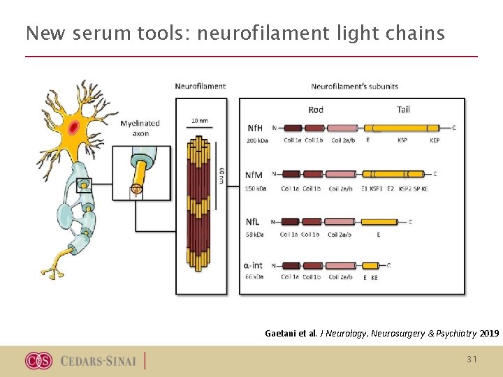 New serum tools: neurofilament light chains Gaetani et al. J Neurology, Neurosurgery & Psychiatry New serum tools: neurofilament light chains Gaetani et al. J Neurology, Neurosurgery & Psychiatry