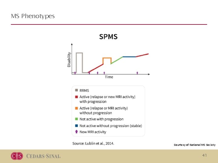 MS Phenotypes Courtesy of National MS Society 41 MS Phenotypes Courtesy of National MS Society 41