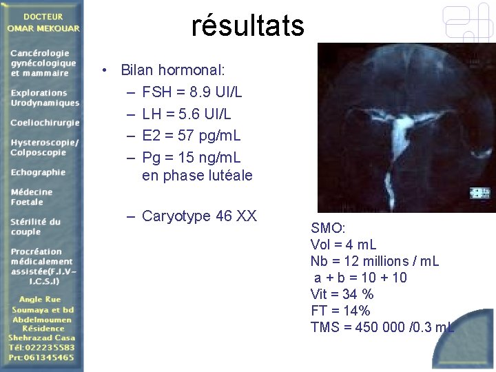 résultats • Bilan hormonal: – FSH = 8. 9 UI/L – LH = 5.