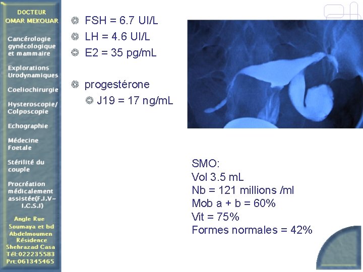 FSH = 6. 7 UI/L LH = 4. 6 UI/L E 2 = 35