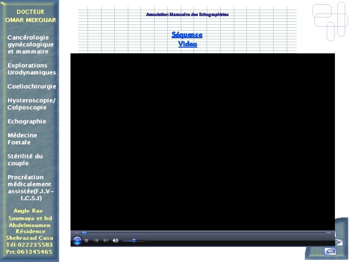 Association Marocaine des Echographistes Séquence Video Quit 