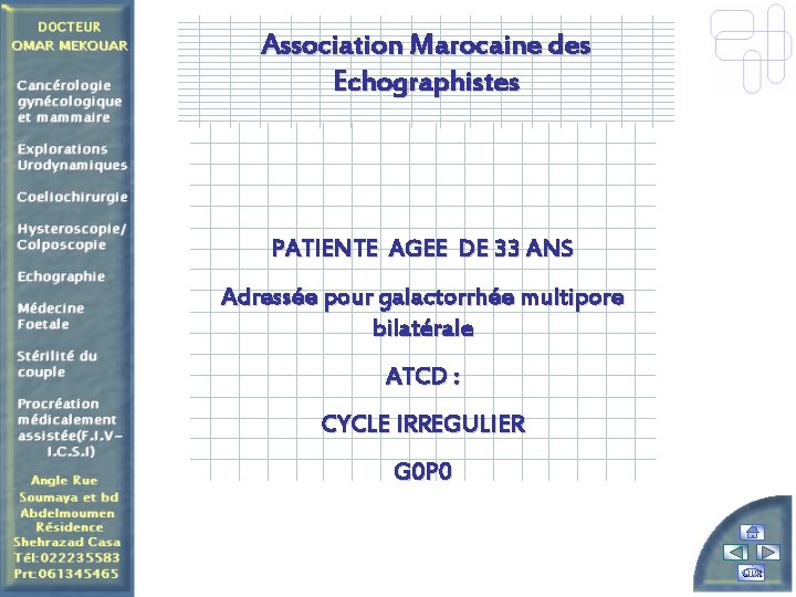 Association Marocaine des Echographistes PATIENTE AGEE DE 33 ANS Adressée pour galactorrhée multipore bilatérale