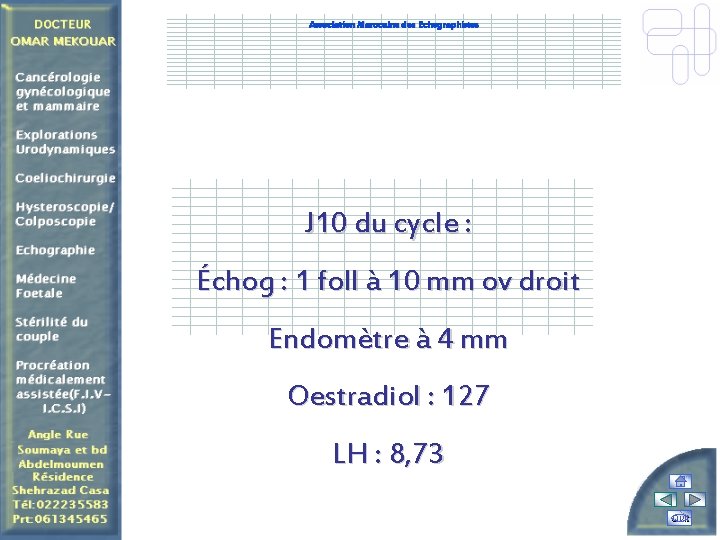 Association Marocaine des Echographistes J 10 du cycle : Échog : 1 foll à