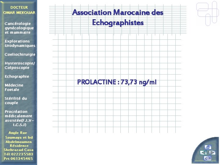 Association Marocaine des Echographistes PROLACTINE : 73, 73 ng/ml Quit 