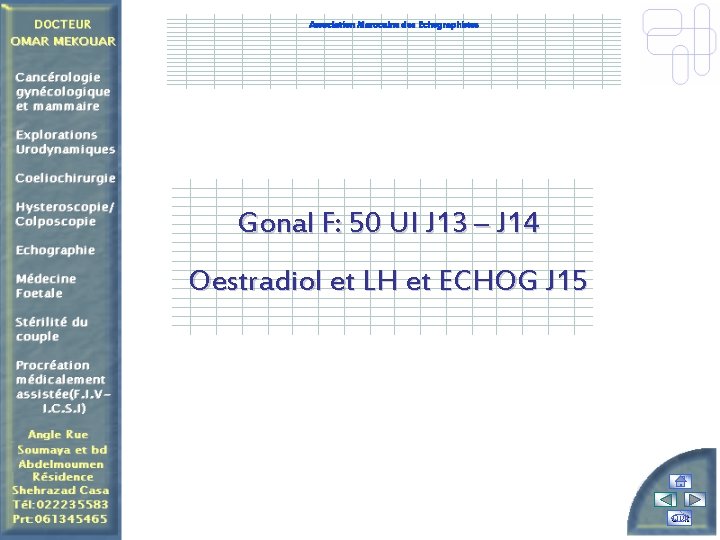 Association Marocaine des Echographistes Gonal F: 50 UI J 13 – J 14 Oestradiol