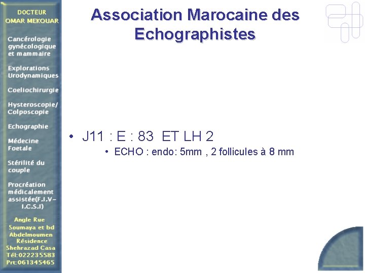 Association Marocaine des Echographistes • J 11 : E : 83 ET LH 2