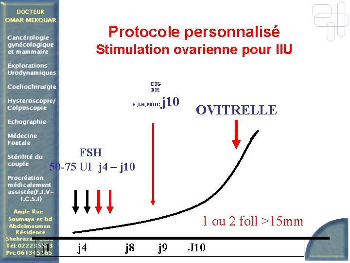 Protocole personnalisé Stimulation ovarienne pour IIU ETG DH: E , LH, PROG j 10