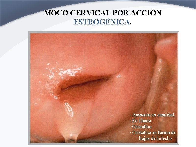 MOCO CERVICAL POR ACCIÓN ESTROGÉNICA. - Aumenta en cantidad. - Es filante. - Cristalino