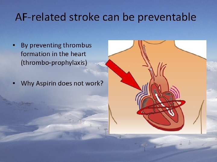 AF-related stroke can be preventable • By preventing thrombus formation in the heart (thrombo-prophylaxis)