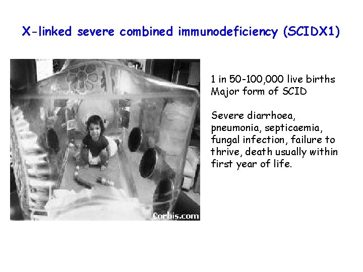 X-linked severe combined immunodeficiency (SCIDX 1) 1 in 50 -100, 000 live births Major