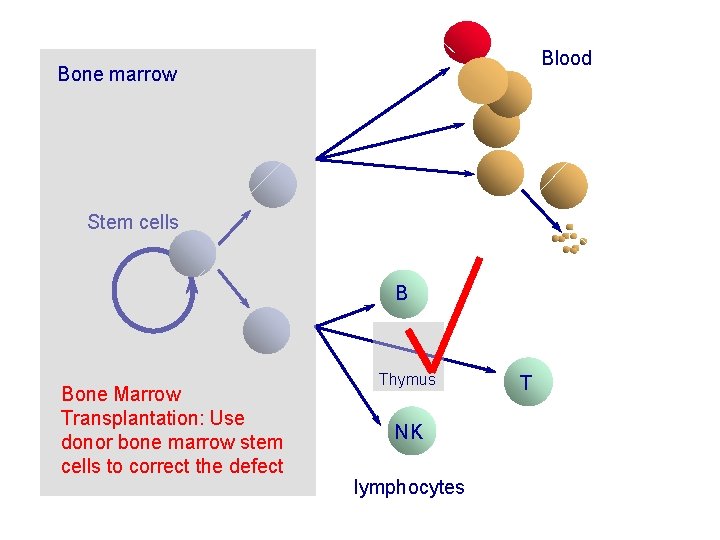 Blood Bone marrow Stem cells B Bone Marrow Transplantation: Use donor bone marrow stem