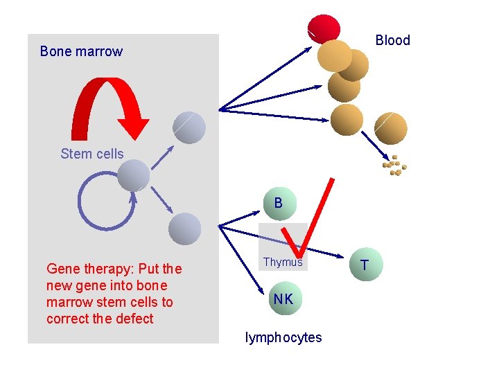 Blood Bone marrow Stem cells B Gene therapy: Put the new gene into bone