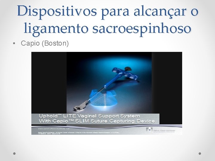 Dispositivos para alcançar o ligamento sacroespinhoso • Capio (Boston) Dispositivos para alcançar o ligamento sacroespinhoso • Capio (Boston)