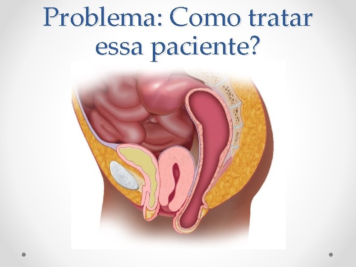 Problema: Como tratar essa paciente? Problema: Como tratar essa paciente?