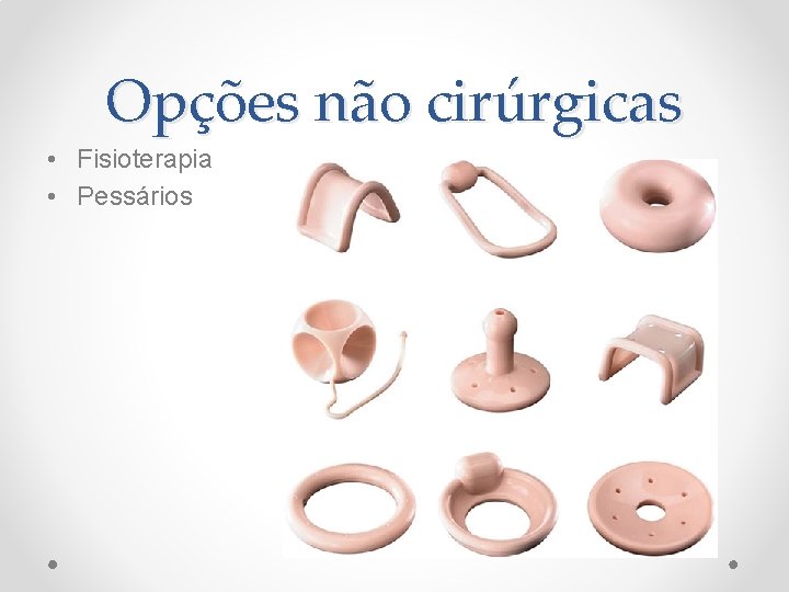 Opções não cirúrgicas • Fisioterapia • Pessários Opções não cirúrgicas • Fisioterapia • Pessários