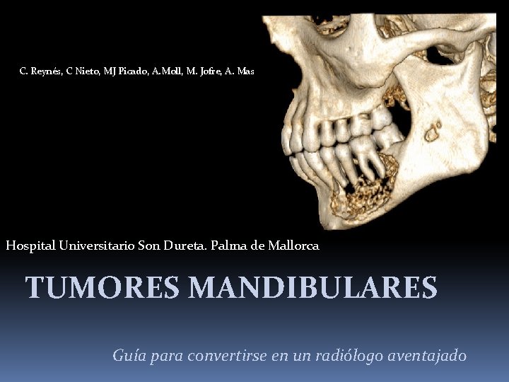 C. Reynés, C Nieto, MJ Picado, A. Moll, M. Jofre, A. Mas Hospital Universitario C. Reynés, C Nieto, MJ Picado, A. Moll, M. Jofre, A. Mas Hospital Universitario