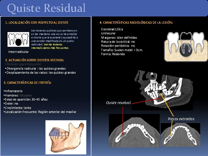 Quiste Residual 1. LOCALIZACIÓN CON RESPECTO AL DIENTE Son lesiones quísticas que permanecen en Quiste Residual 1. LOCALIZACIÓN CON RESPECTO AL DIENTE Son lesiones quísticas que permanecen en