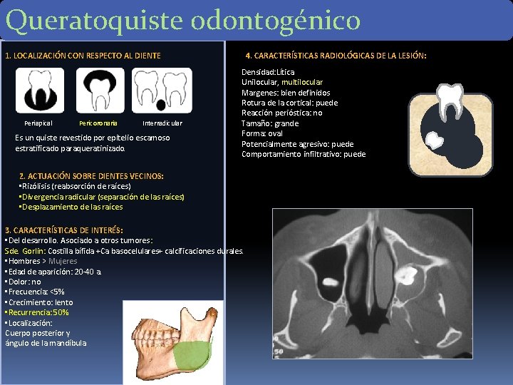 Queratoquiste odontogénico 1. LOCALIZACIÓN CON RESPECTO AL DIENTE Periapical Pericoronaria Interradicular Es un quiste Queratoquiste odontogénico 1. LOCALIZACIÓN CON RESPECTO AL DIENTE Periapical Pericoronaria Interradicular Es un quiste
