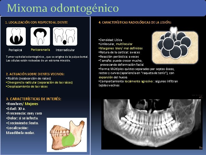 Mixoma odontogénico 1. LOCALIZACIÓN CON RESPECTO AL DIENTE Periapical Pericoronaria Interradicular Tumor epitelial odontogénico Mixoma odontogénico 1. LOCALIZACIÓN CON RESPECTO AL DIENTE Periapical Pericoronaria Interradicular Tumor epitelial odontogénico