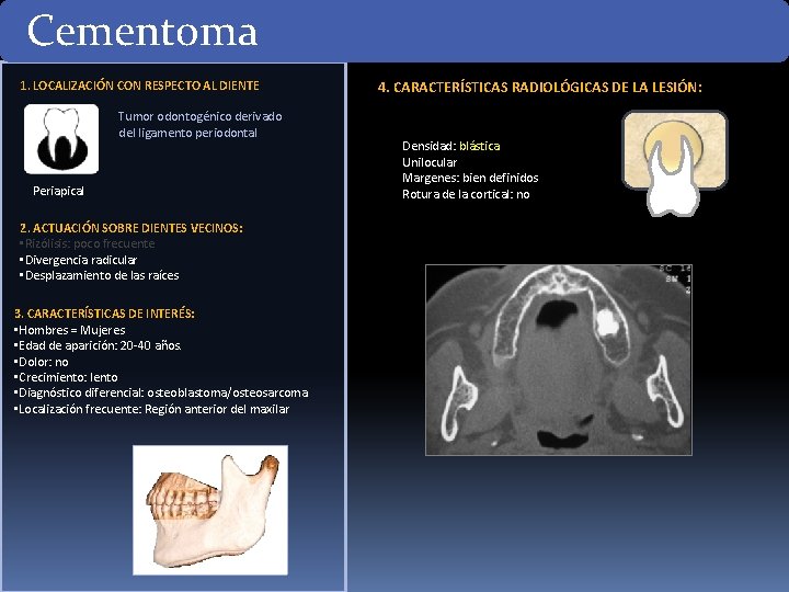 Cementoma 1. LOCALIZACIÓN CON RESPECTO AL DIENTE Tumor odontogénico derivado del ligamento periodontal Periapical Cementoma 1. LOCALIZACIÓN CON RESPECTO AL DIENTE Tumor odontogénico derivado del ligamento periodontal Periapical