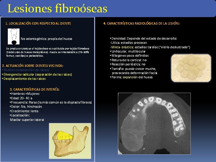Lesiones fibroóseas 1. LOCALIZACIÓN CON RESPECTO AL DIENTE No odontogénica: propia del hueso Se Lesiones fibroóseas 1. LOCALIZACIÓN CON RESPECTO AL DIENTE No odontogénica: propia del hueso Se