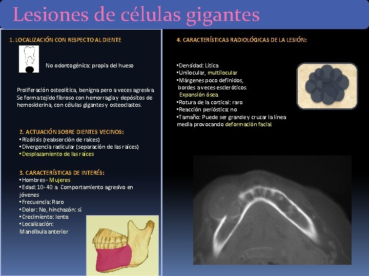 Lesiones de células gigantes 1. LOCALIZACIÓN CON RESPECTO AL DIENTE No odontogénica: propia del Lesiones de células gigantes 1. LOCALIZACIÓN CON RESPECTO AL DIENTE No odontogénica: propia del