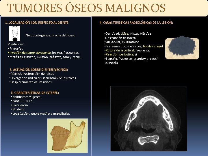 TUMORES ÓSEOS MALIGNOS 1. LOCALIZACIÓN CON RESPECTO AL DIENTE No odontogénica: propia del hueso TUMORES ÓSEOS MALIGNOS 1. LOCALIZACIÓN CON RESPECTO AL DIENTE No odontogénica: propia del hueso