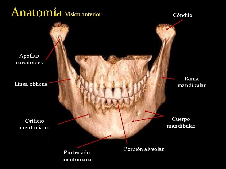 Anatomía Visión anterior Cóndilo Apófisis coronoides Rama mandibular Línea oblicua Cuerpo mandíbular Orificio mentoniano Anatomía Visión anterior Cóndilo Apófisis coronoides Rama mandibular Línea oblicua Cuerpo mandíbular Orificio mentoniano
