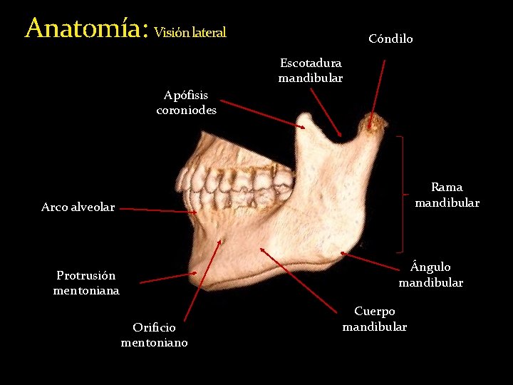 Anatomía: Visión lateral Cóndilo Escotadura mandibular Apófisis coroniodes Rama mandibular Arco alveolar Ángulo mandibular Anatomía: Visión lateral Cóndilo Escotadura mandibular Apófisis coroniodes Rama mandibular Arco alveolar Ángulo mandibular
