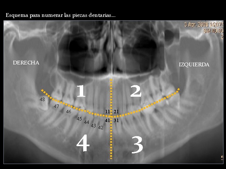 Esquema para numerar las piezas dentarias… DERECHA IZQUIERDA 1 48 47 2 46 11 Esquema para numerar las piezas dentarias… DERECHA IZQUIERDA 1 48 47 2 46 11