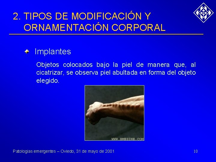 2. TIPOS DE MODIFICACIÓN Y ORNAMENTACIÓN CORPORAL Implantes Objetos colocados bajo la piel de