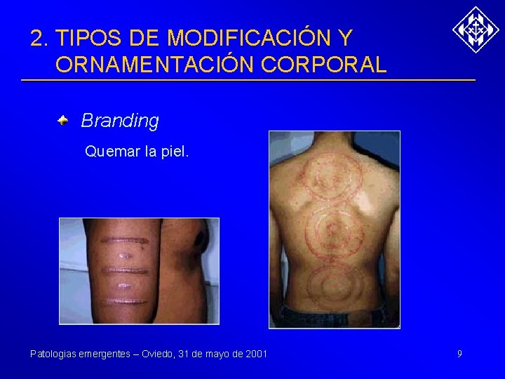 2. TIPOS DE MODIFICACIÓN Y ORNAMENTACIÓN CORPORAL Branding Quemar la piel. Patologias emergentes –