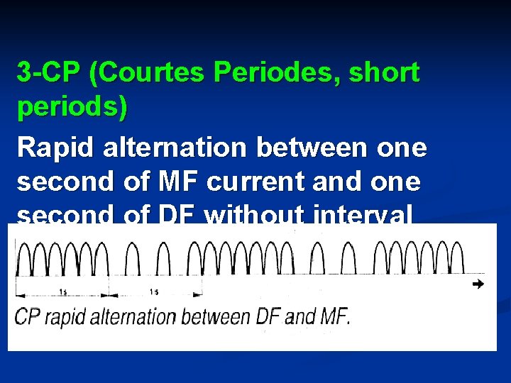 3 -CP (Courtes Periodes, short periods) Rapid alternation between one second of MF current