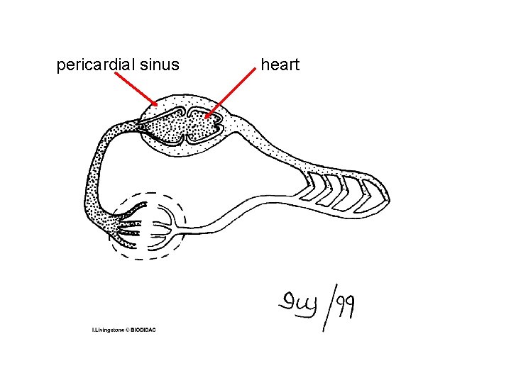 pericardial sinus heart 