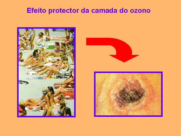 Efeito protector da camada do ozono 