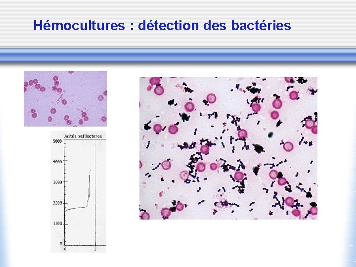 Hémocultures : détection des bactéries 