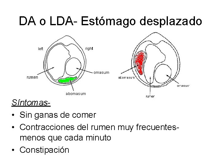 DA o LDA- Estómago desplazado Síntomas • Sin ganas de comer • Contracciones del DA o LDA- Estómago desplazado Síntomas • Sin ganas de comer • Contracciones del