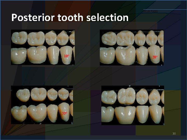 Posterior tooth selection 10° SELECTION 20° 33° 30 