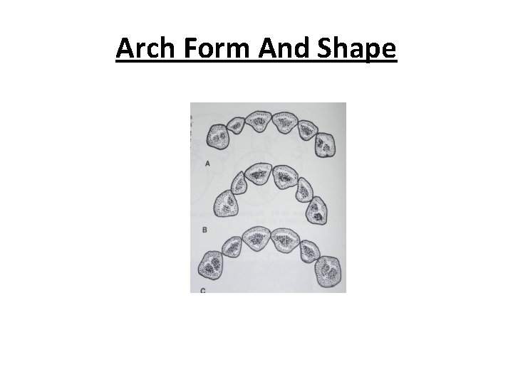 Arch Form And Shape 