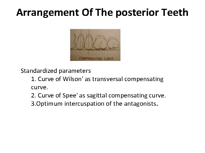 Arrangement Of The posterior Teeth Standardized parameters 1. Curve of Wilson' as transversal compensating