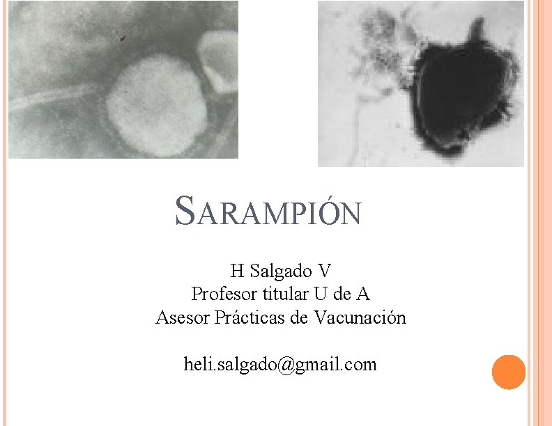 SARAMPIÓN H Salgado V Profesor titular U de A Asesor Prácticas de Vacunación heli.